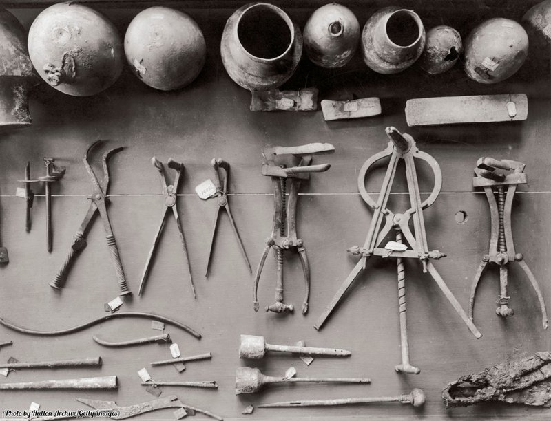 Ancient Roman Surgical Instruments