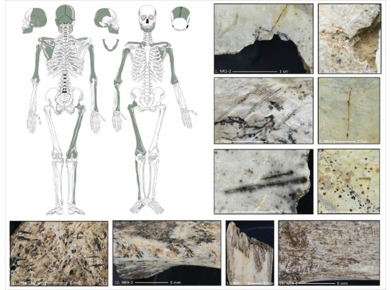 Cannibalism In Prehistoric Archaeological Evidence